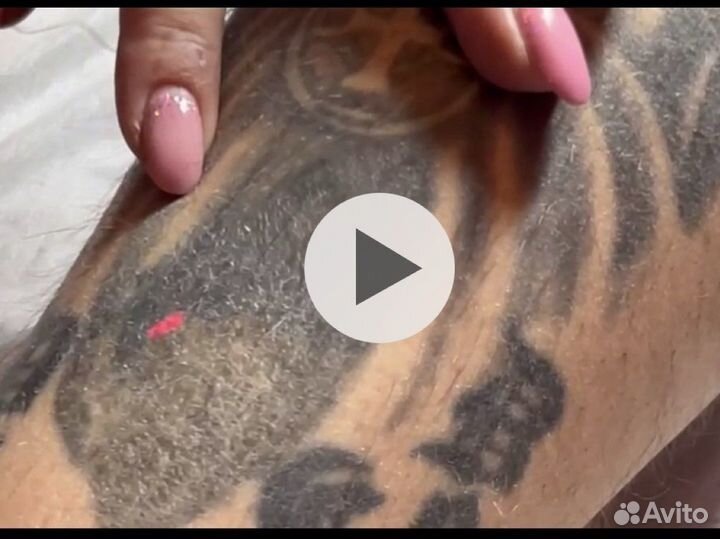 Удаление тату/ татуажа/карбоновый пилинг