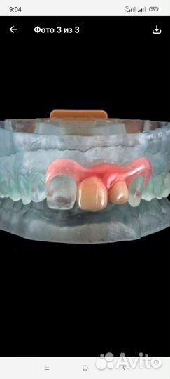 Услуги зубного техника