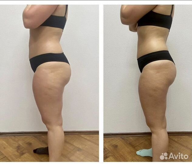 Массаж коррекция фигуры