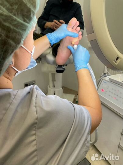 Вросшие ногти, мозоли, сухая кожа, подолог