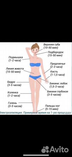 Электроэпиляция