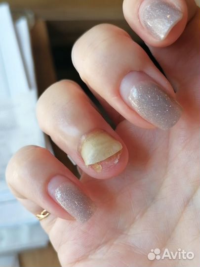 Медицинский педикюр. Подолог Адлер, Сириус