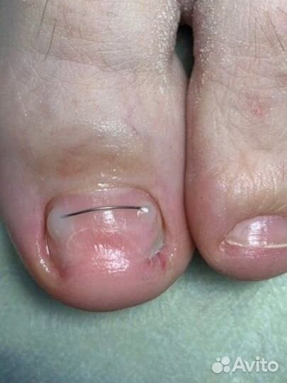 Подолог в центре