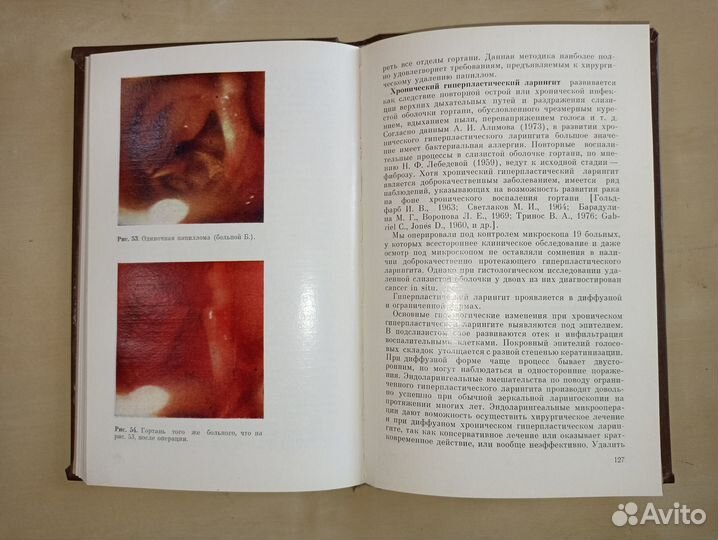 Микроларингоскопия и эндоларингеальная микрохирург