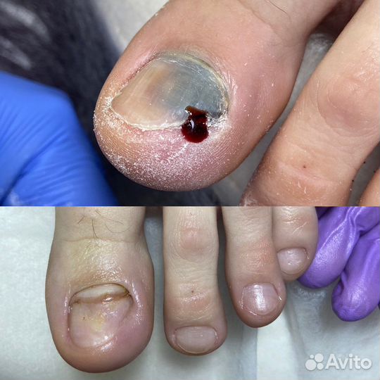 Услуги подолога