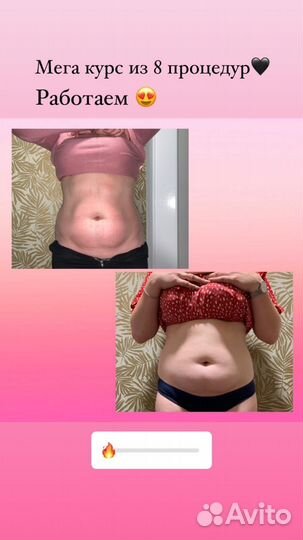 Аппаратная коррекция фигуры