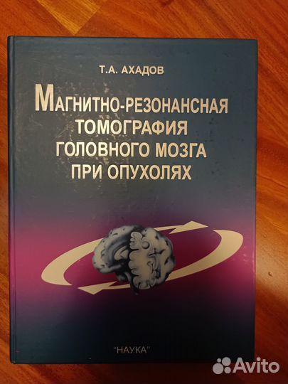 Магнитно-резонансная томография головного мозга