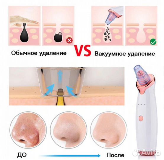Вакуумный очиститель пор