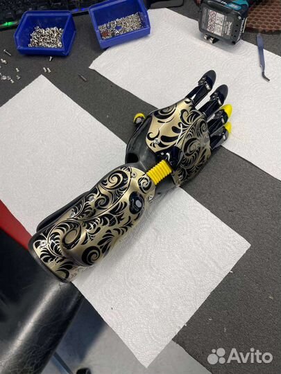 Бионический протез