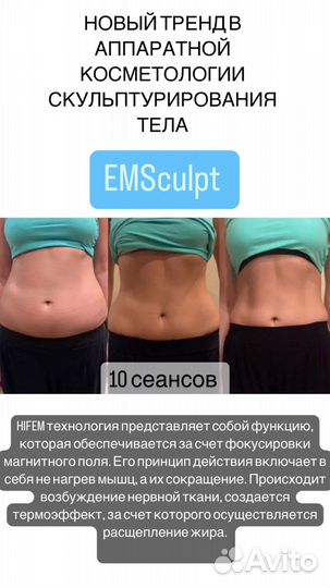 Emsculpt процедура до -3 см за сеанс, похудение