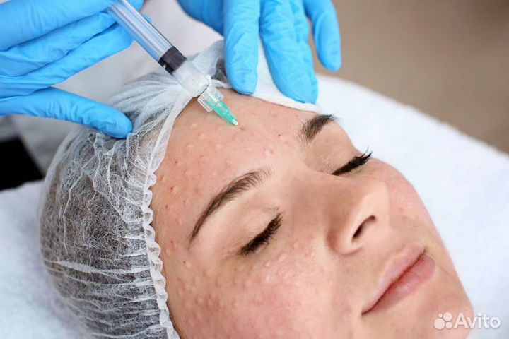 Косметолог, мезотерапия, биоревитализация, чистки