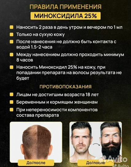 Monoxidil для роста волос и бороды