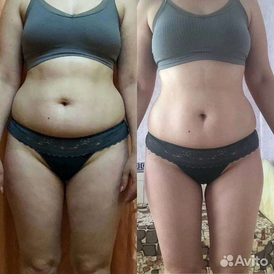 Lpg массажа антицеллюлитный массаж