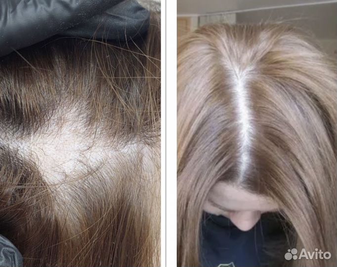 Накладки из натуральных волос имитация кожи