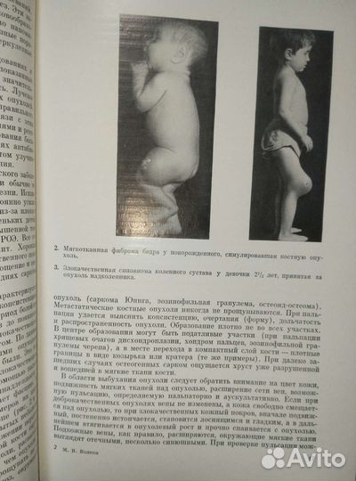 Болезни костей у детей. М.В.Волков.ссср 1974г