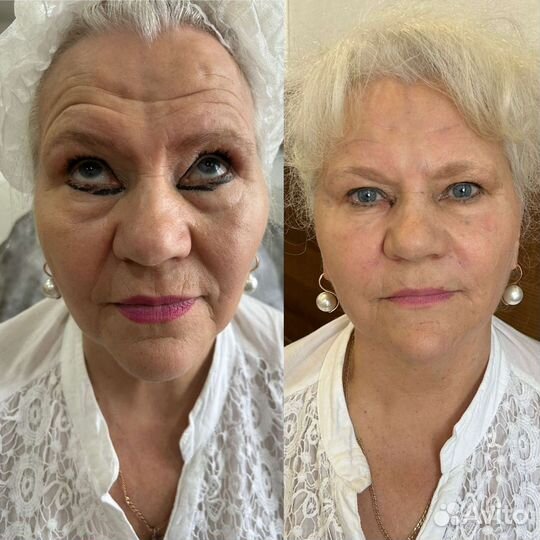 Врач-косметолог, 21 год опыт работы