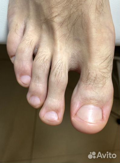 Подолог, смарт педикюр, маникюр