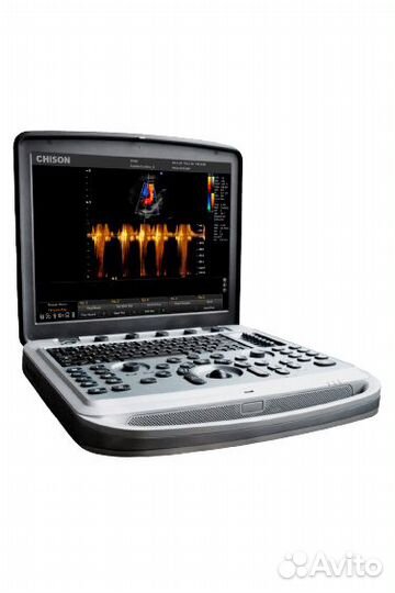 Узи-аппарат Chison SonoBook 8