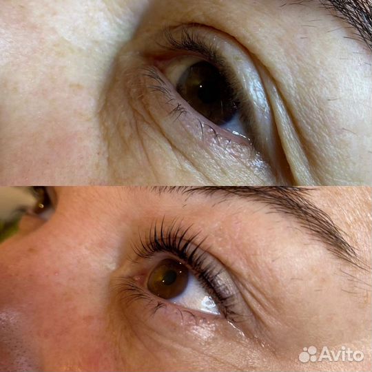 Ламинирование и ботокс ресниц