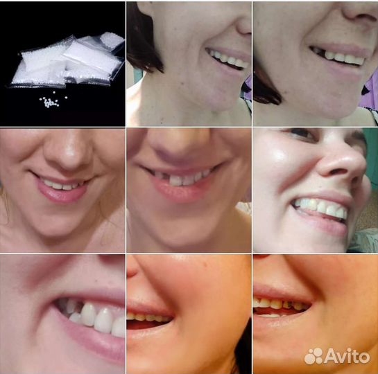 Литые горошки для зубов цена за 1 пакет