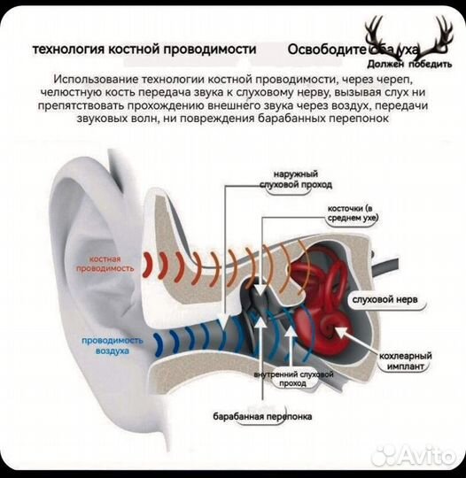 Слуховой наушник с котсной проводимостью