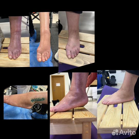 Реабилитация