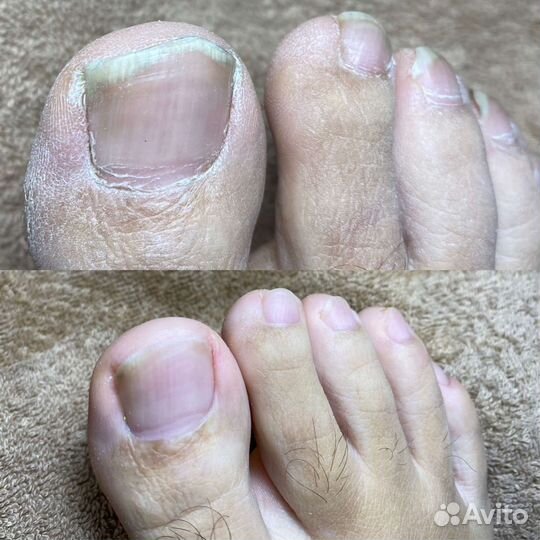 Педикюр- мастера Михаил/Светлана (Nail-студия)