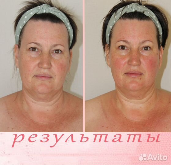 Массаж лица