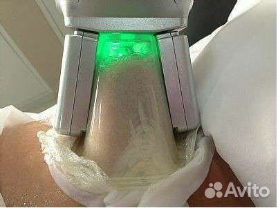 Процедура криолиполиз