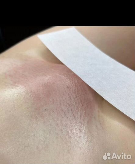 Шугаринг и восковая депиляция