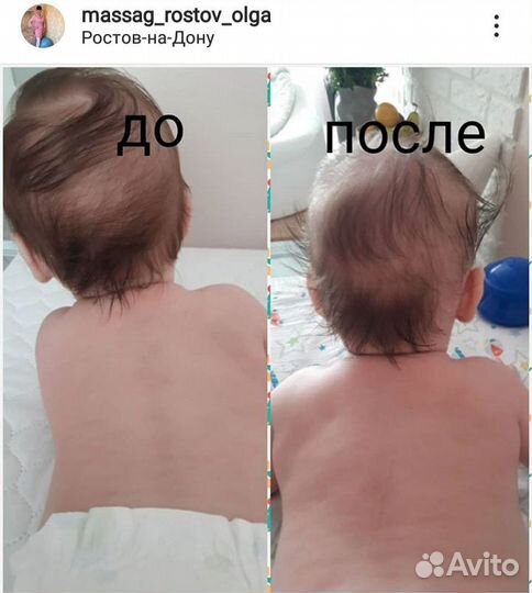 Детский массажист