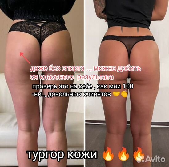 Массаж Коррекция фигуры / Забудь про боль