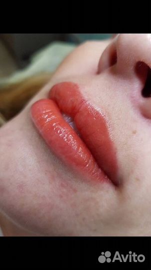 Перманентный макияж (брови,губы,веки.) Удаление пм