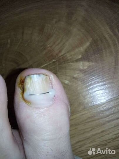 Гигиенический и эстетический педикюр (выезд на дом