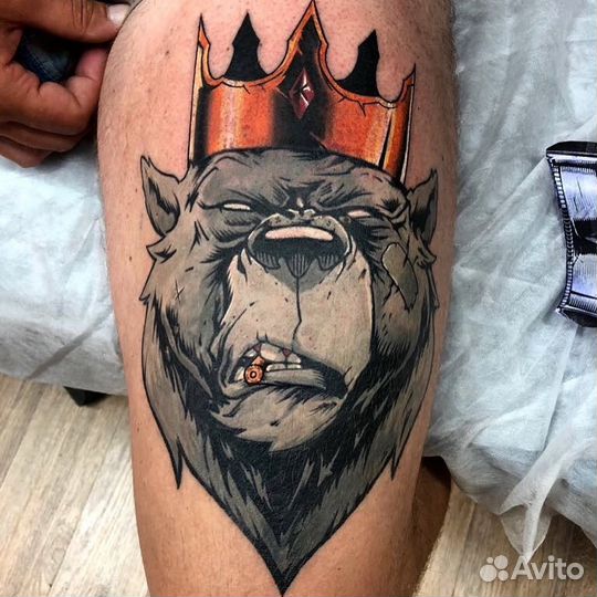 Удаление татуировок