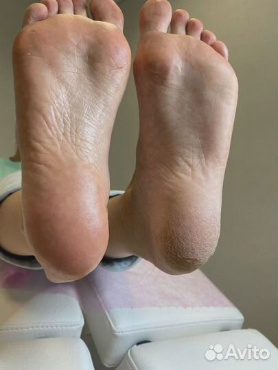 Услуги подолога, решение для проблемных ступней