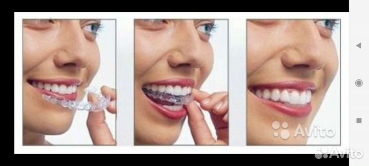 Ремонт изготовление зубные протезы, каппы