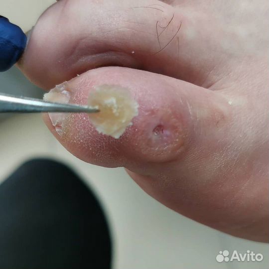 Подология/Маникюр Luxio