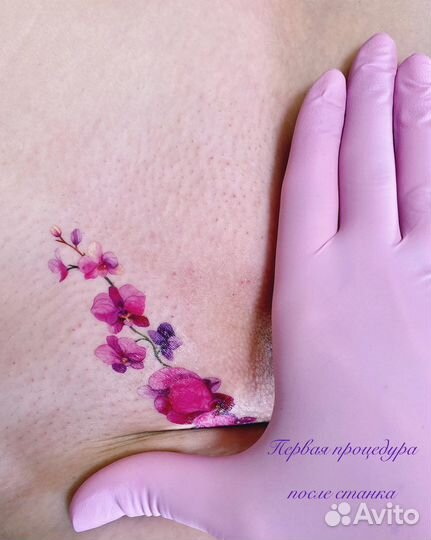 Шугаринг женский сжм