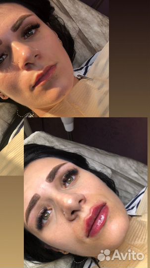 Услуги косметолога