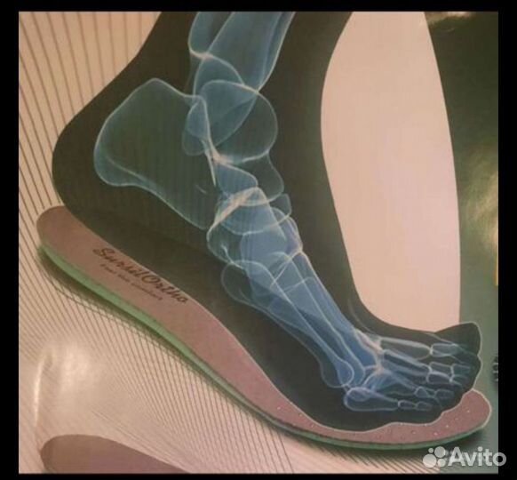 Изготовление индивидуальных ортопедических стелек