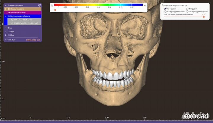 ExoCad 3.1 Rijeka + Exoplan 3.1 Rijeka Актуальные