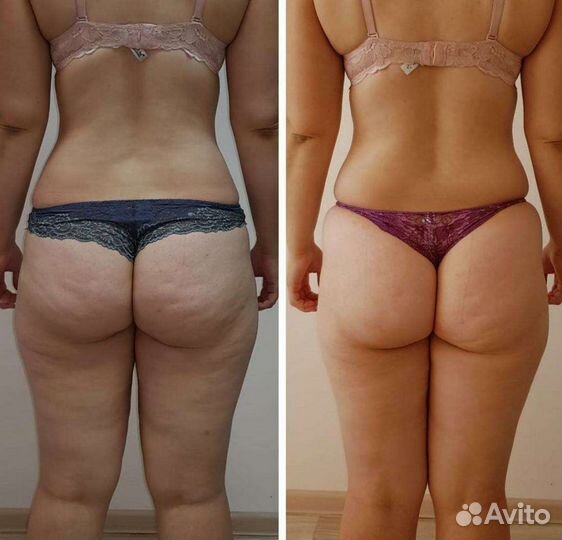 Массаж для здоровья и красоты