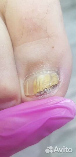 Услуги подолога