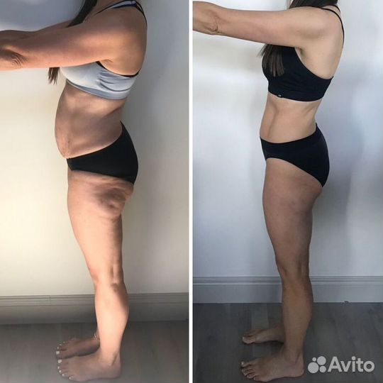 Массаж, СПА процедуры