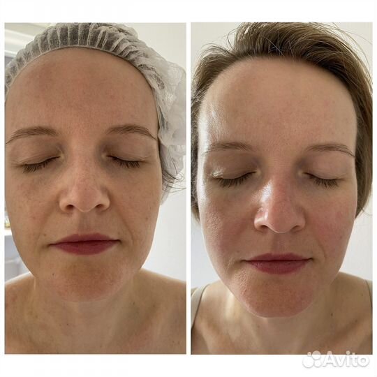 Массаж тела