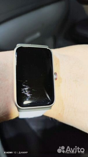 Honor choice band-68D