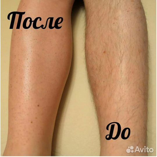 Шугаринг,ваксинг