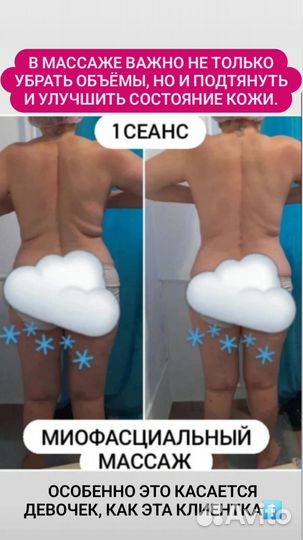 Антицеллюлитный массаж