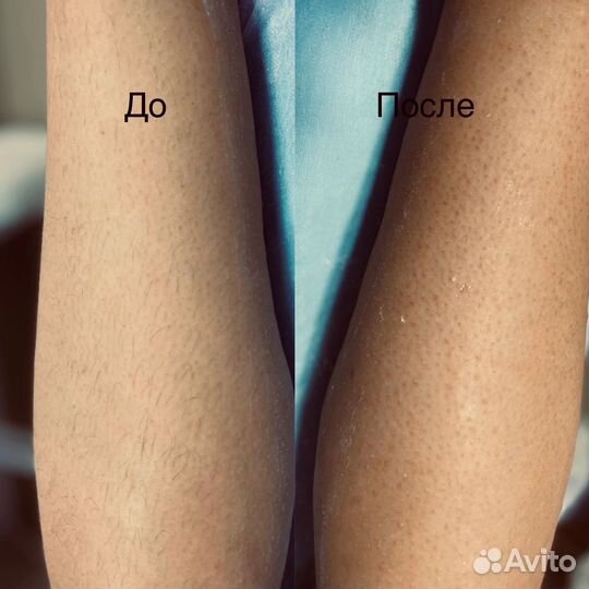 Мастер депиляции